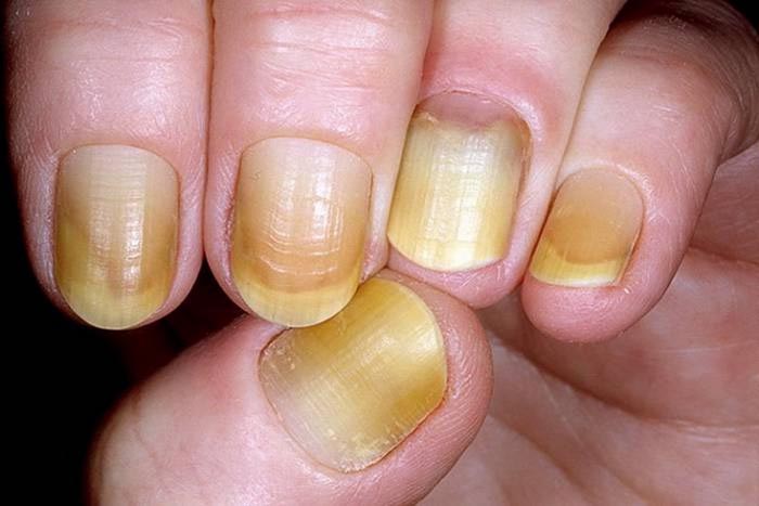 Yellow and White French Tip Nails - wide 11