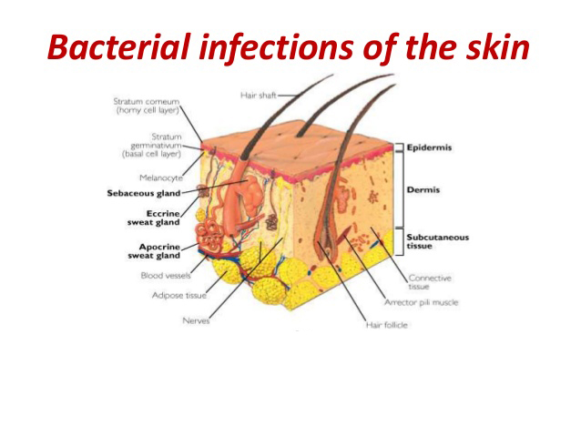 Bacterial Infections